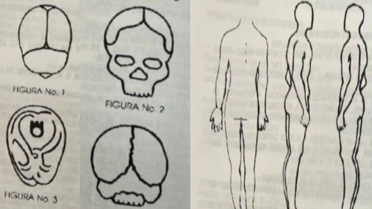 Las Dos Autopsias De Debanhi Escobar