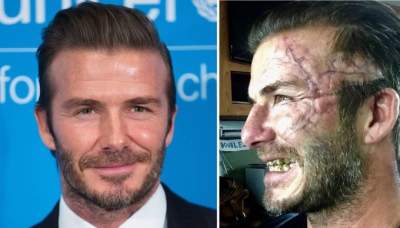 ¡David Beckham desfigurado!