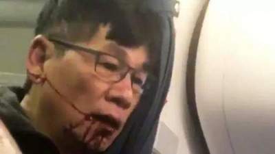 Pasajero expulsado a la fuerza de avión demandará a United Airlines