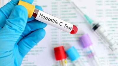  Existen 325 millones de personas enfermas de hepatitis: OMS