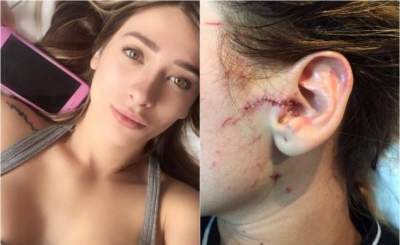 Brenda Zambrano, de "Acapulco Shore", muestra su herida tras agresión