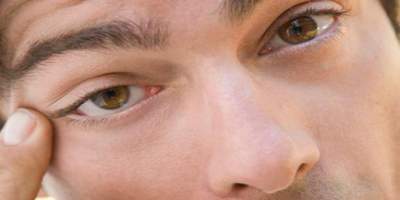 ¿Por qué a veces nos tiembla el párpado de un ojo? Conoce las causas