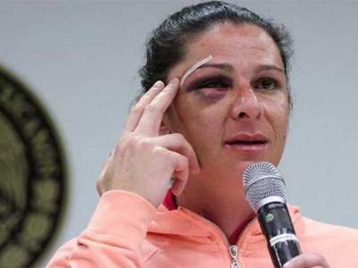 Suspenden proceso a agresor de Guevara a cambio de pagar 60 mil pesos