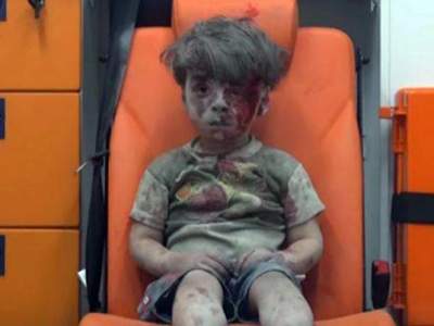Así luce hoy el pequeño Omran, el niño sirio que sobrevivió a un bomba