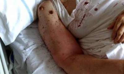 Paciente convalece rodeado de hormigas en cama de hospital en Italia