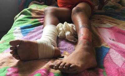 Niño sufre quemaduras por falla geotérmica en Michoacán