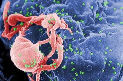 Niña con VIH logra suprimir ocho años la enfermedad