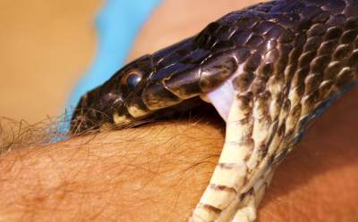Mordeduras de serpiente problema de salud pública: OMS