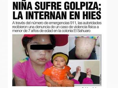 Sospechan que niña maltratada en Sonora habría sido robada en Edomex