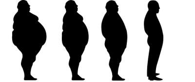Lo que debes saber sobre la obesidad mórbida
