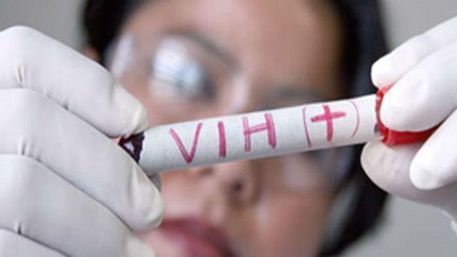 Epidemia de VIH: 33 mexicanos se infectan al día, alertan