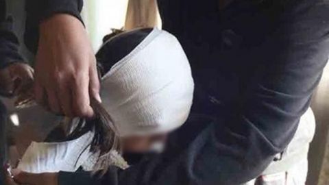 Perros pitbull atacan a niña de 10 años en Ciudad Juárez