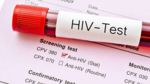 Una adolescente contrae el VIH, ¡Cada 3 minutos!