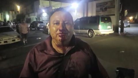 Agreden a reportero en Mexicali