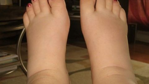¿Por qué mis pies están hinchados?