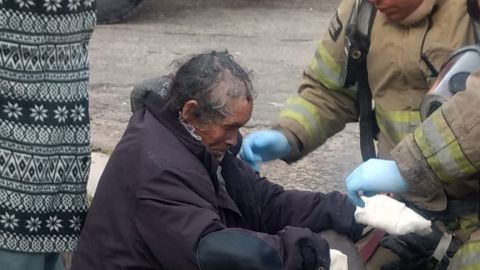 Mujer sufre quemaduras en su cuerpo por dejar la estufa encendida