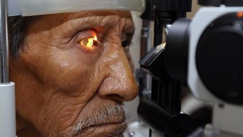 IMSS realiza más de 600 mil consultas por glaucoma