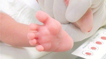 ¿En qué consiste la Prueba del Tamiz Neonatal?