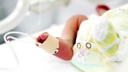La bebé prematura más pequeña del mundo sale del hospital en California
