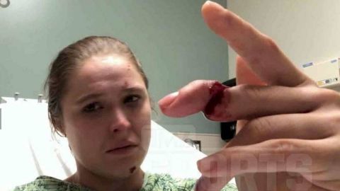 Ronda Rousey se rompe brutalmente el dedo en su visita a México