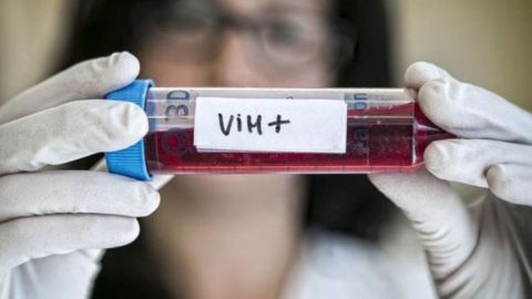 Terapia mejora calidad de vida de pacientes con VIH