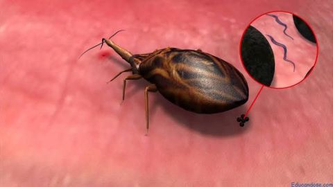 Enfermedad de Chagas también causa cardiopatías