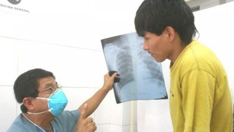 Tijuana registra más casos de tuberculosis en el país