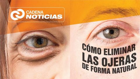 Cómo eliminar las ojeras de forma natural