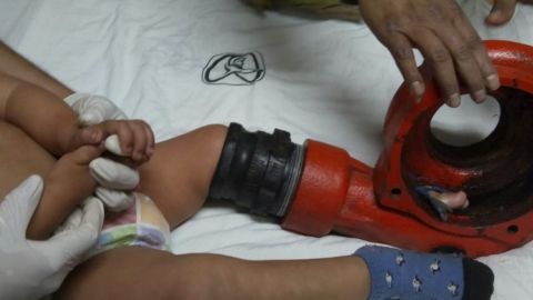 Niño de tres años tiene accidente con motobomba | Su pierna se atoro dentro