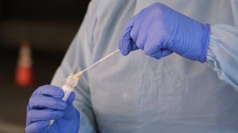 Prohíben a laboratorios privados ofertar pruebas de coronavirus