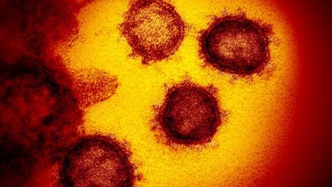 125 muertos y 2 mil 439 positivos por coronavirus en México