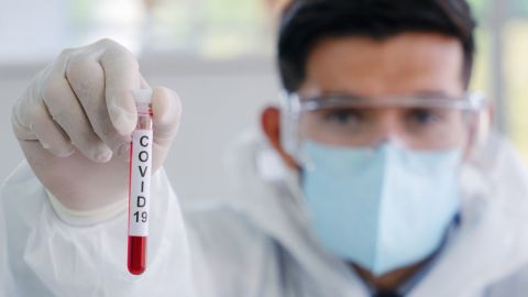 Casos confirmados de Covid-19 estado por estado al 30 de abril