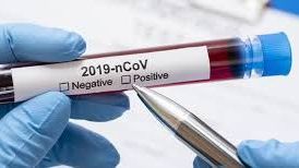 Médico de Issste  Ensenada da positivo por Covid-19