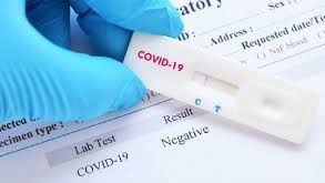 Aumenta la demanda de pruebas Covid-19 en Cicese
