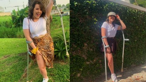 Joven con una pierna responde con humor a críticas en redes sociales