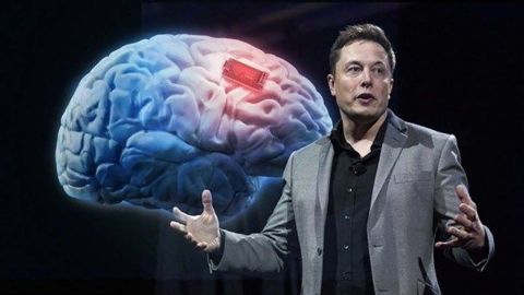 Elon Musk presenta primer prueba de Neuralinks, chips implantados en el cerebro
