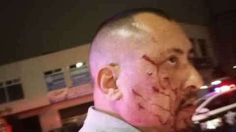 VIDEO: Golpiza a taxista, lesionan su ojo, intentaron asaltarlo