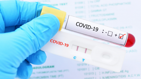 Trump anuncia plan para distribuir 150 millones de tests rápidos de COVID-19