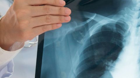 Radiología, clave en los diagnósticos, dice IMSS