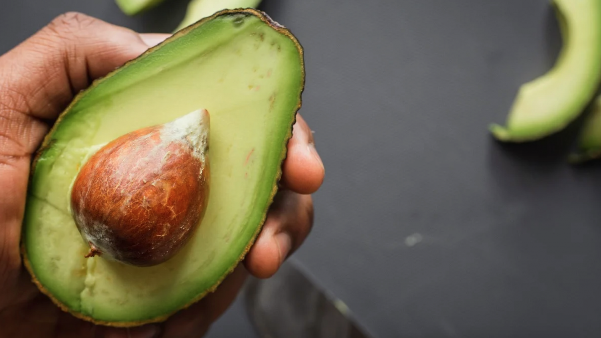 Consumir Aguacate Ayuda A La Salud Intestinal