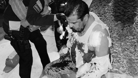 Conductor de Didi recibió dos disparos en el rostro tras ser asaltado