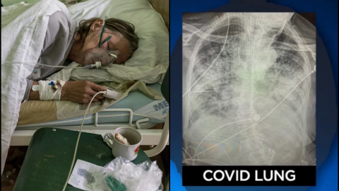 Covid-19 daña más a los pulmones que el cigarro: experta