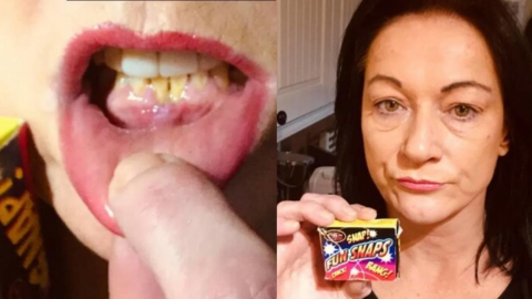 Mujer confunde FUEGOS ARTIFICIALES con DULCES; le provocaron QUEMADURAS
