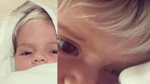 Pequeña nace con canas a causa de una extraña condición genética