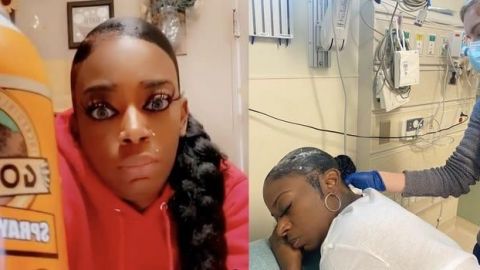 VIDEO: Retiran el PEGAMENTO industrial del pelo de INFLUENCER