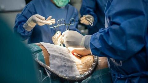 Médico le arranca el útero en vez de la placenta y la mujer muere