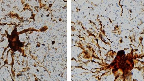 Estudio descubre células zombis que siguen creciendo después de la muerte