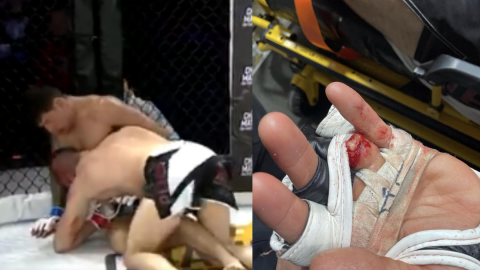 VIDEO: Peleador de artes marciales mixtas pierde su dedo durante combate