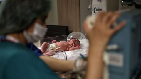 Médicos de Irak registran el primer caso de bebé con tres penes