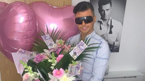 Hombre gasta miles de dólares para parecerse a 'Ken' y este fue su resultado